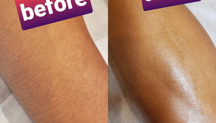 腕beforeafter