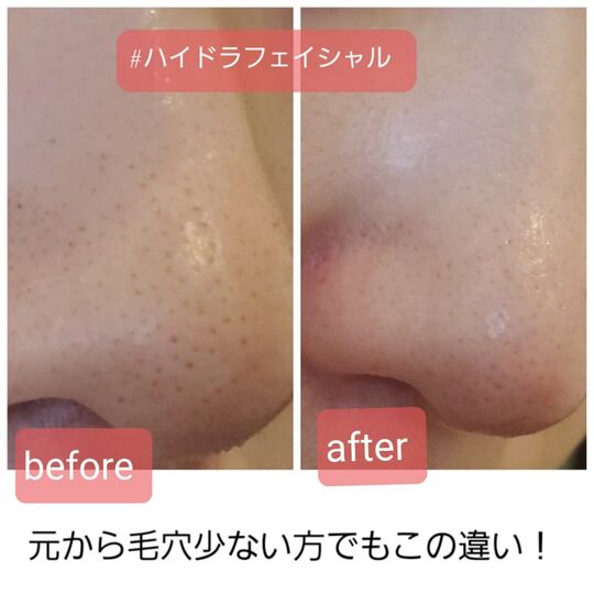 鼻　画像