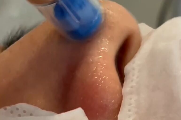 Screenshot_20210608-131441_Gallery